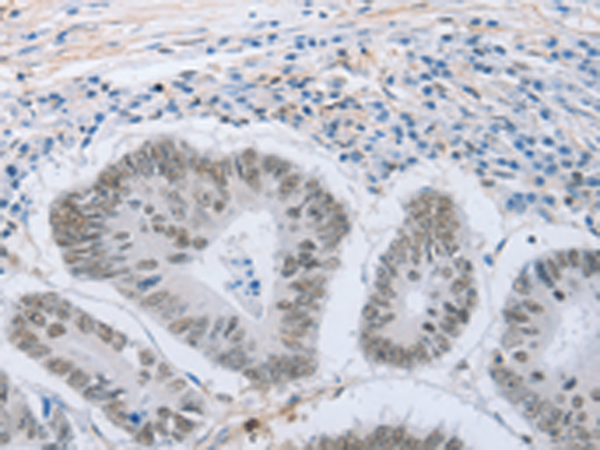 Rabbit Polyclonal Antibody to NEUROG2