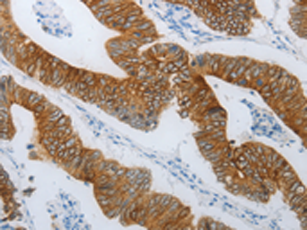 Rabbit Polyclonal Antibody to TMEM8B