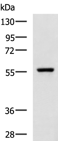 Rabbit Polyclonal Antibody to SLC5A5
