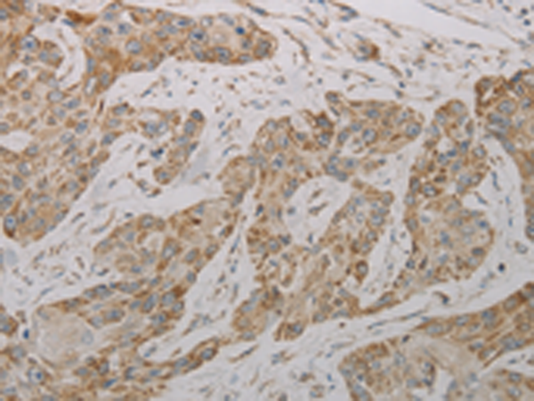 Rabbit Polyclonal Antibody to TAC1