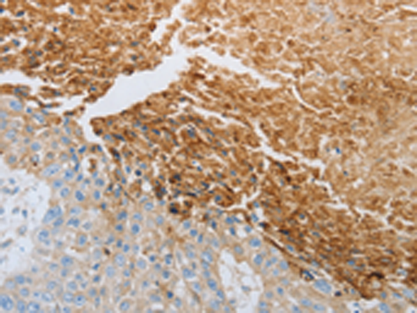 Rabbit Polyclonal Antibody to RTN4