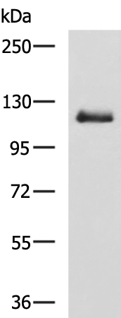 Rabbit Polyclonal Antibody to NOTCH2