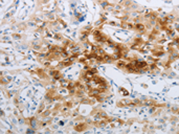 Rabbit Polyclonal Antibody to NPY2R