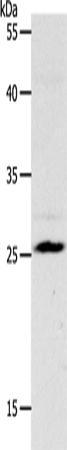 Rabbit Polyclonal Antibody to NQO2