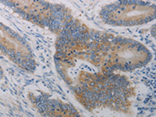 Rabbit Polyclonal Antibody to CLEC4C