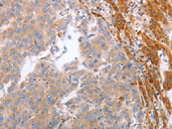Rabbit Polyclonal Antibody to NRTN