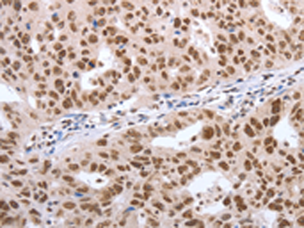 Rabbit Polyclonal Antibody to POU3F1