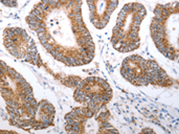 Rabbit Polyclonal Antibody to HCRTR1