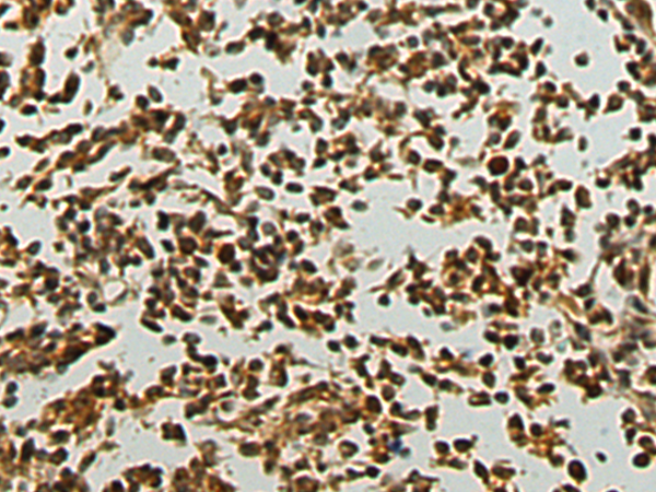 Rabbit Polyclonal Antibody to PALB2