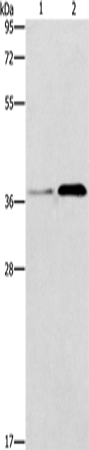 Rabbit Polyclonal Antibody to PAFAH2