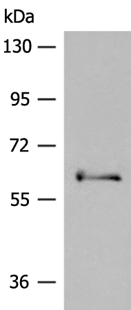 Rabbit Polyclonal Antibody to PAK3