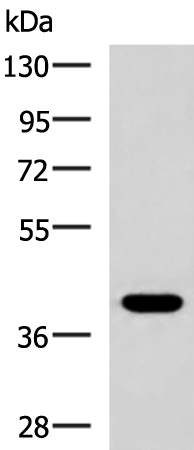 Rabbit Polyclonal Antibody to PLPPR5