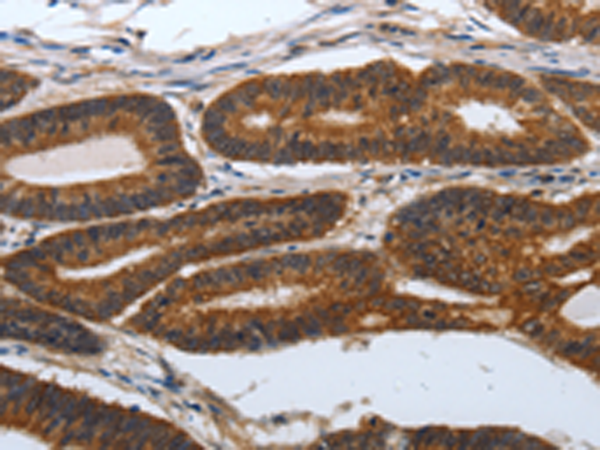 Rabbit Polyclonal Antibody to PDCD7
