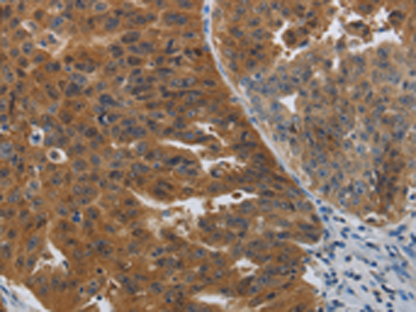 Rabbit Polyclonal Antibody to PDCD2