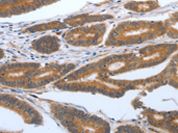 Rabbit Polyclonal Antibody to PODXL