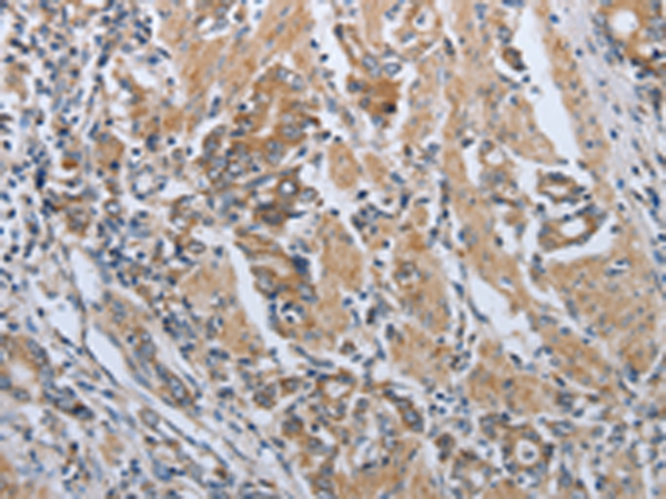 Rabbit Polyclonal Antibody to PDCD1