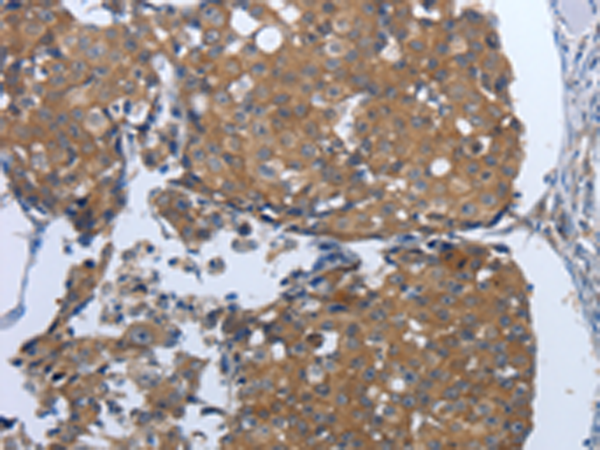 Rabbit Polyclonal Antibody to PDIA2