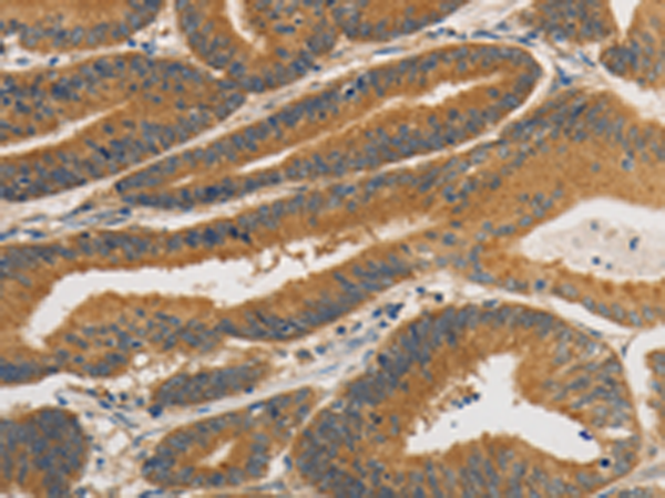 Rabbit Polyclonal Antibody to PRKD1
