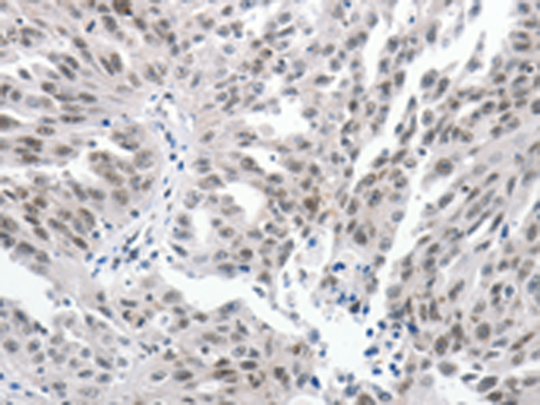 Rabbit Polyclonal Antibody to PKD2