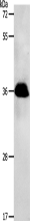 Rabbit Polyclonal Antibody to PPP2CB