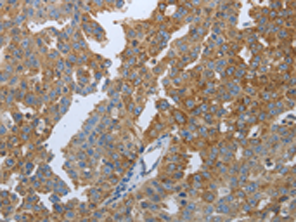 Rabbit Polyclonal Antibody to PPARG