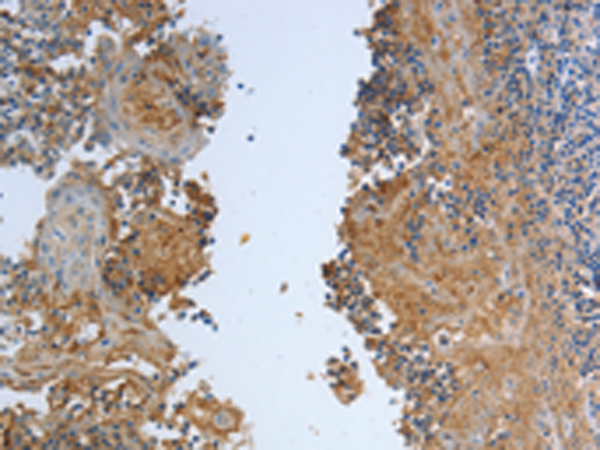 Rabbit Polyclonal Antibody to DLG4