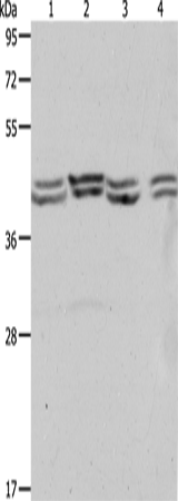 Rabbit Polyclonal Antibody to PSMD6