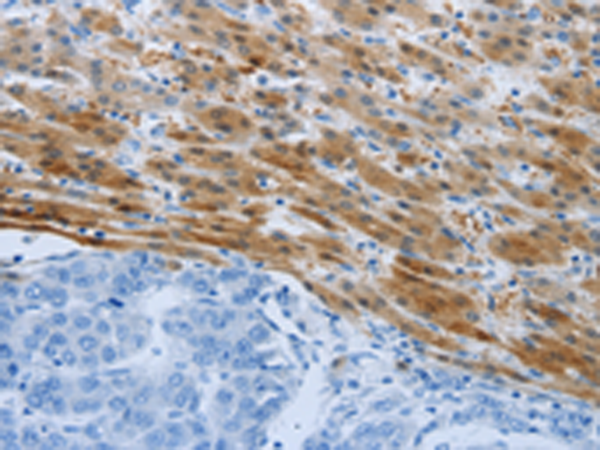 Rabbit Polyclonal Antibody to PSMD11