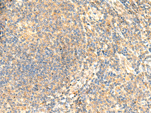 Rabbit Polyclonal Antibody to PTEN