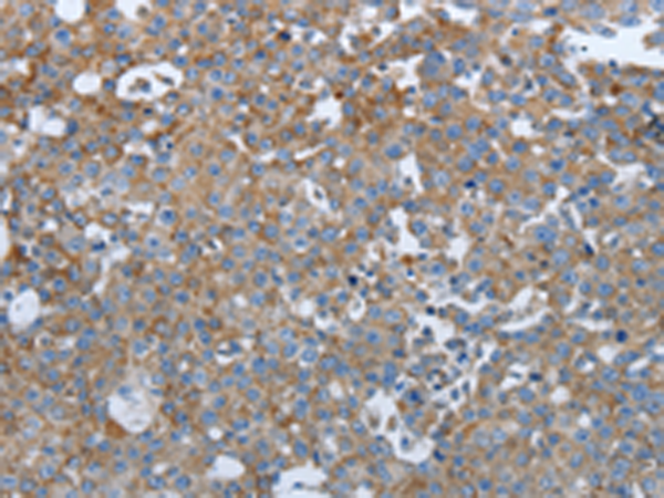 Rabbit Polyclonal Antibody to PTPRJ