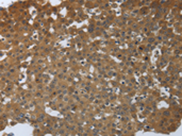 Rabbit Polyclonal Antibody to PTPRM