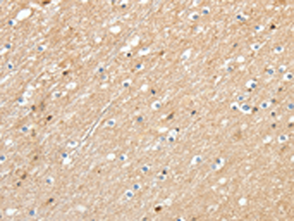 Rabbit Polyclonal Antibody to RRAD