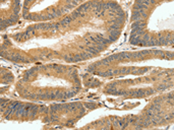 Rabbit Polyclonal Antibody to S100A4