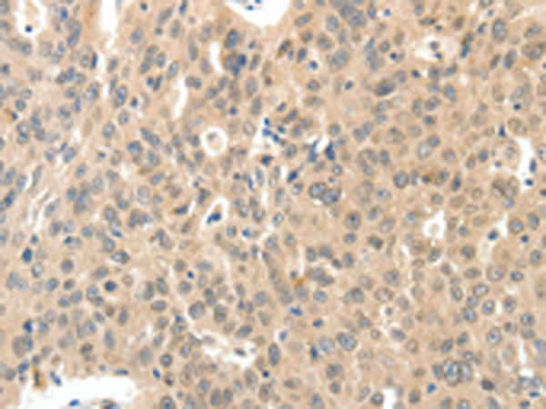 Rabbit Polyclonal Antibody to ROS1