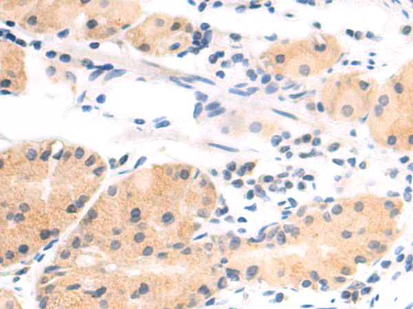 Rabbit Polyclonal Antibody to AMD1