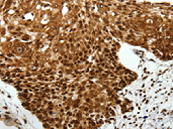 Rabbit Polyclonal Antibody to SCN1A