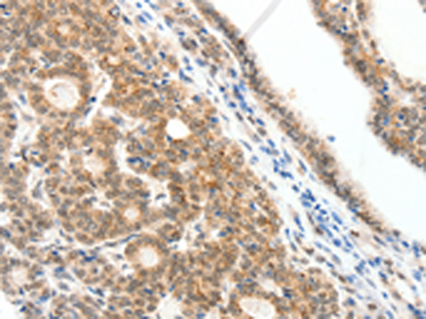 Rabbit Polyclonal Antibody to SCN2A