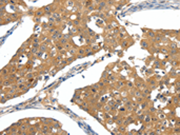Rabbit Polyclonal Antibody to SCN5A