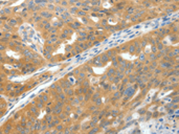 Rabbit Polyclonal Antibody to SCN9A