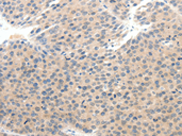 Rabbit Polyclonal Antibody to SCN10A