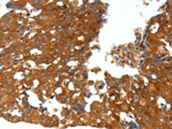Rabbit Polyclonal Antibody to CXCL12