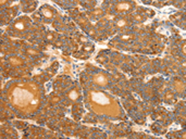 Rabbit Polyclonal Antibody to SCT