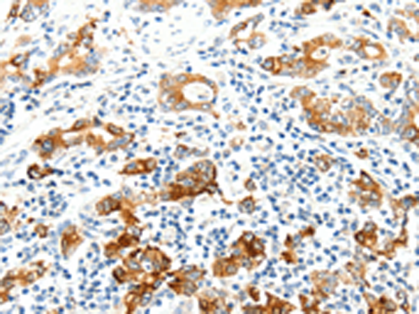Rabbit Polyclonal Antibody to SEL1L