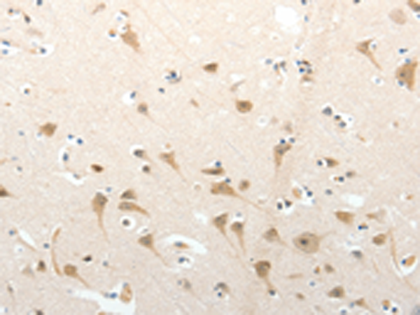 Rabbit Polyclonal Antibody to SEMA3D