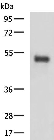 Rabbit Polyclonal Antibody to SLC2A4RG