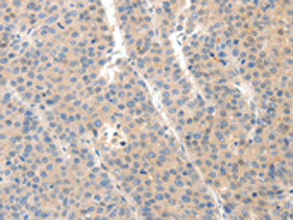 Rabbit Polyclonal Antibody to SLC20A1