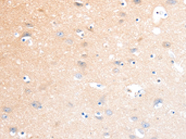 Rabbit Polyclonal Antibody to SLC22A17