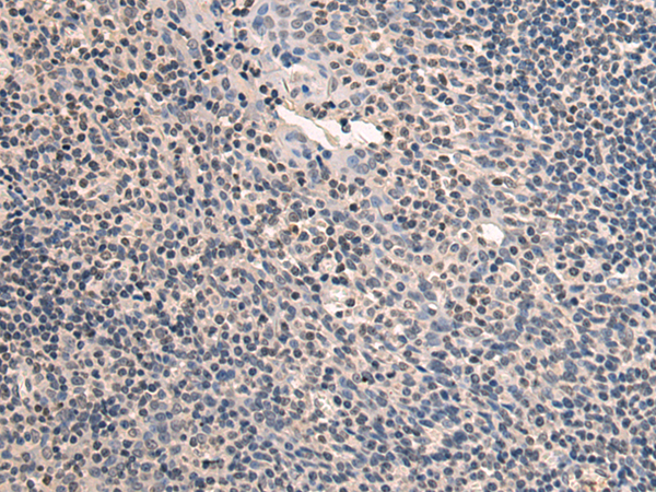 Rabbit Polyclonal Antibody to SLC24A1