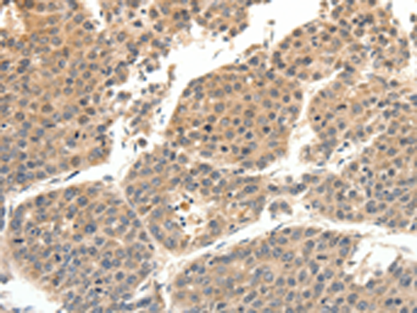 Rabbit Polyclonal Antibody to SLC27A1