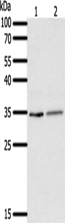 Rabbit Polyclonal Antibody to SFTPA1